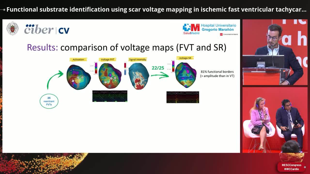 Mapping in arrhythmias