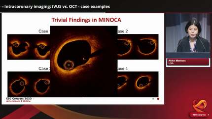 Presentation thumbnail