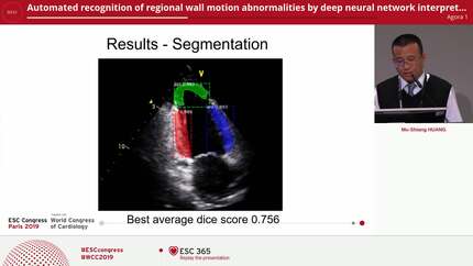 Automated recognition of regional wall motion abnormalities by deep neural network interpretation of echocardiography