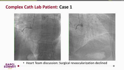 Defining the complex cath lab patient: cases, protocols and the NAP role