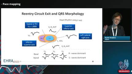 Substrate mapping for VT in ICM: different strategies, similar targets?