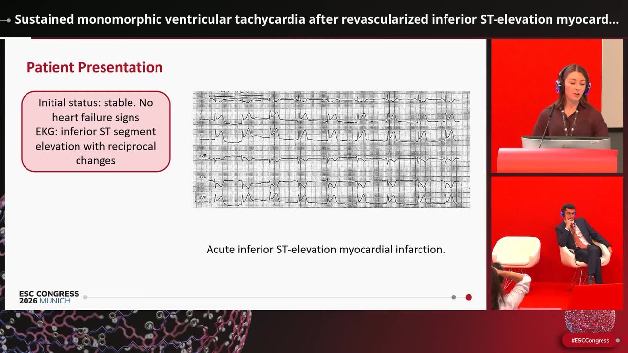 The collision of rhythm and perfusion: clinical cases of ventricular arrhythmias
