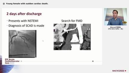Young female with sudden cardiac death.
