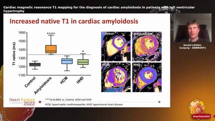 Cardiac magnetic resonance T1 mapping for the diagnosis of cardiac amyloidosis in patients with left ventricular hypertrophy