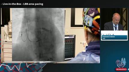 Live case session: physiological pacing