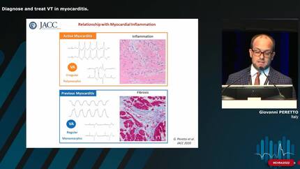 Diagnose and treat VT in myocarditis.