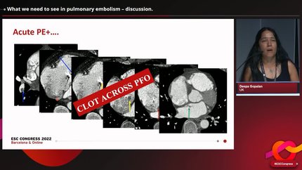 Presentation thumbnail
