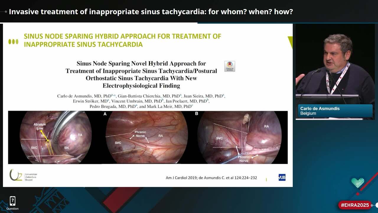 Invasive treatment of inappropriate sinus tachycardia: for whom? when? how?