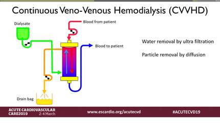 Renal replacement therapies: techniques, indications and results.