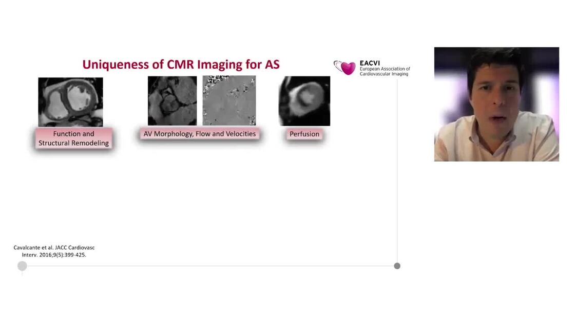 Esc 365 Multi Modality Imaging In Aortic Stenosis