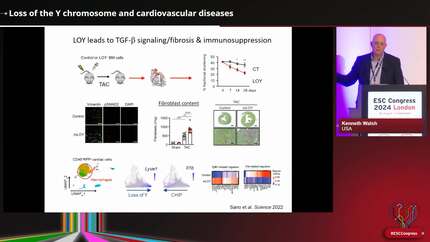 Loss of the Y chromosome and cardiovascular diseases