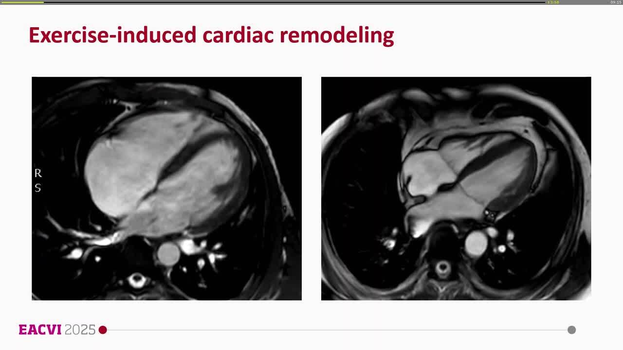 CMR and sports: from diagnosis to risk stratification