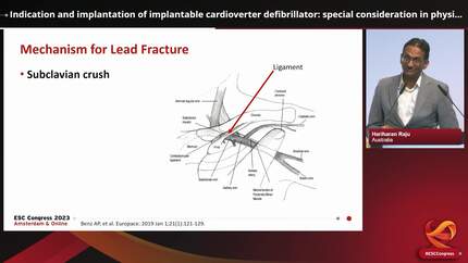 Indication and implantation of implantable cardioverter defibrillator: special consideration in physically active individuals