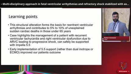 Multi-disciplinary approach in fatal ventricular arrhythmias and refractory shock stabilized with axillary mechanical support as a bridge to heart transplant in ARVC. 