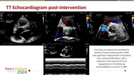 Presentation thumbnail