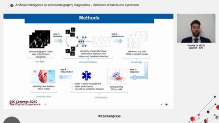 Artificial intelligence in echocardiography diagnostics -  detection of takotsubo syndrome