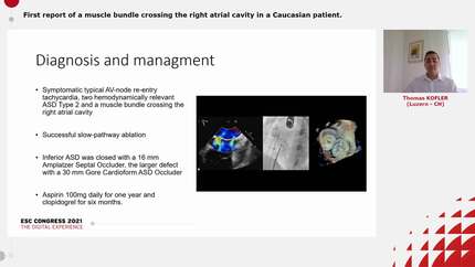 Presentation thumbnail
