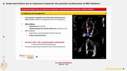 Acute heart failure due to melanoma treatment: the potential cardiotoxicity of MEK inhibitors.