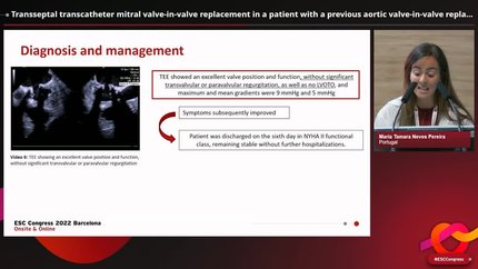Transseptal transcatheter mitral valve-in-valve replacement in a patient with a previous aortic valve-in-valve replacement: how to fix a murmur.
