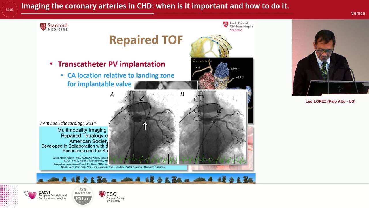 Imaging the coronary arteries in CHD: when is it important and how to do it.