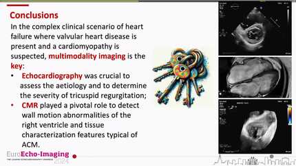 From valvular disease to cardiomyopathy: multimodality imaging is the key.  