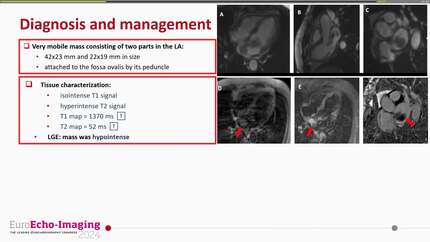 Incidentally detected left atrial mass in a patient with complications after colonoscopy: myxoma, vegetation or thrombus?