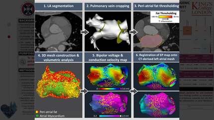 Spatial relationship between left peri-atrial fat with underlying arrhythmogenic substrate in patients with atrial fibrillation - innocent bystander or culprit?