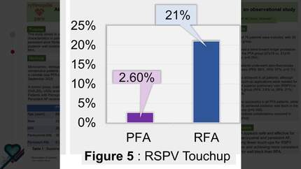 Atrial Fibrillation ablation using variable loop pulse field ablation in the real world: an observational study