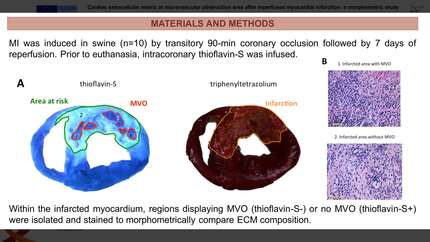 Cardiac extracellular matrix at microvascular obstruction area after reperfused myocardial infarction: a morphometric study