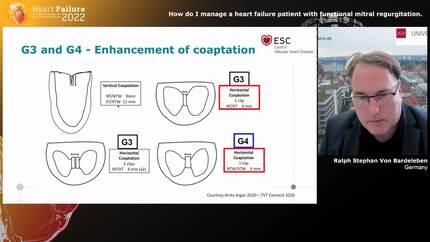 Presentation thumbnail