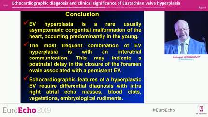 Echocardiographic diagnosis and clinical significance of Eustachian valve hyperplasia