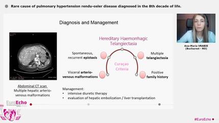 Rare cause of pulmonary hypertension  rendu-osler disease diagnosed in the 8th decade of life.