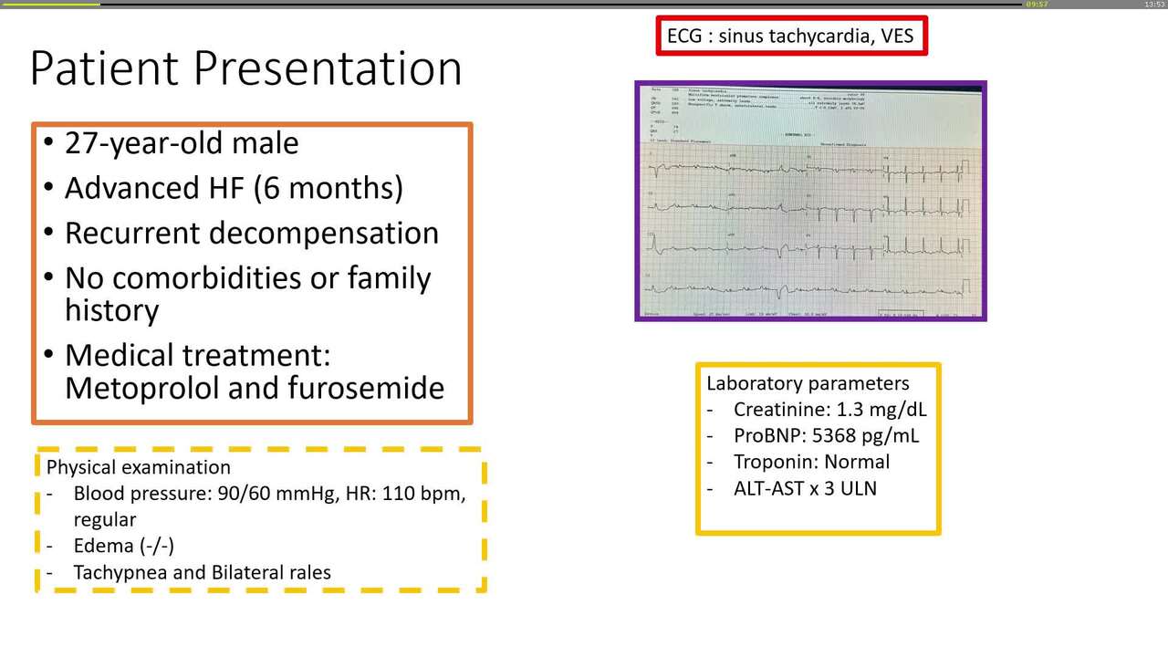 Durable mechanical circulatory support in the real world: from implant decisions to complications