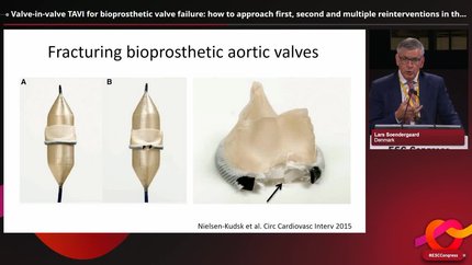 Presentation thumbnail