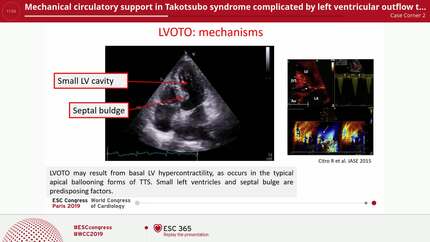 Presentation thumbnail