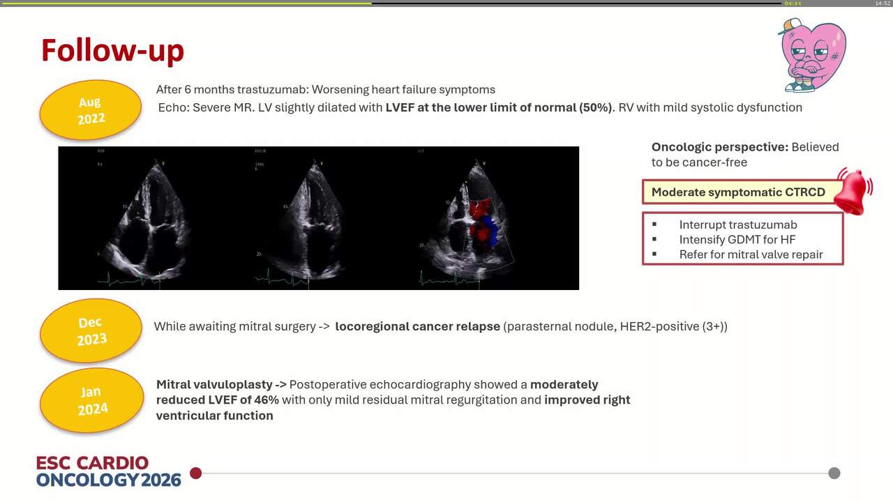 The road to heart failure: untold stories