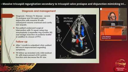 Massive tricuspid regurgitation secondary to tricuspid valve prolapse and disjunction mimicking tricuspid cleft required surgical treatment.