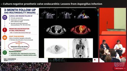 Non-bacterial endocarditis: complex management decisions illustrated through cases