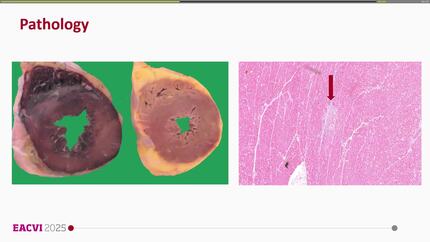 Presentation thumbnail