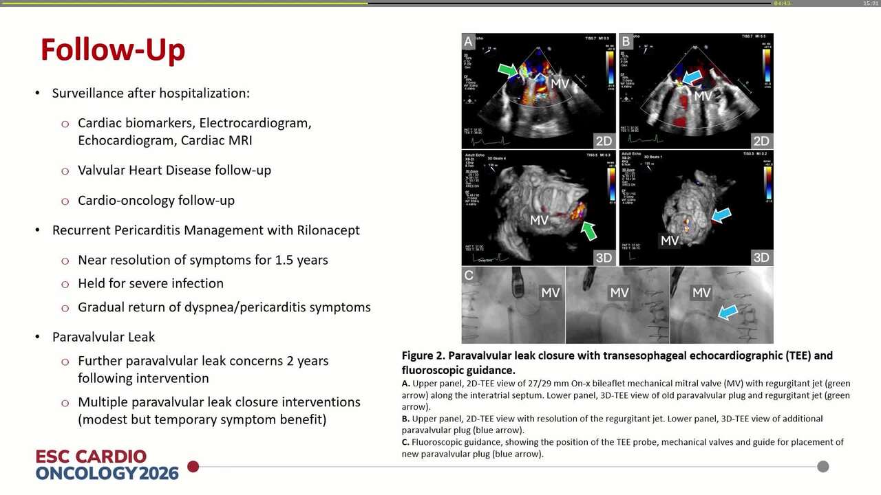 Multimodal diagnosis and management strategy in chemo- and radiotherapy-induced complex cardiomyopathy