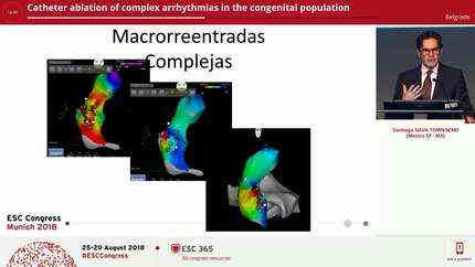 Catheter ablation of complex arrhythmias in the congenital population