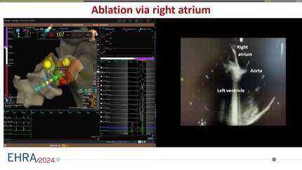 Presentation thumbnail