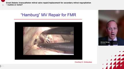 Great Debate: transcatheter mitral valve repair/replacement for secondary mitral regurgitation – routine or niche?