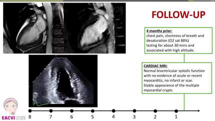 Presentation thumbnail