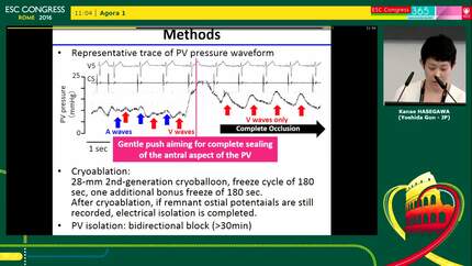 Impact of continuous monitoring of the pulmonary venous pressure on the acute results of cryoablation: A derivation and validation study.