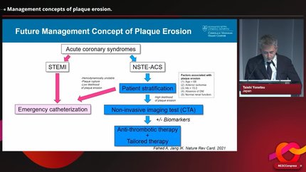 Management concepts of plaque erosion.
