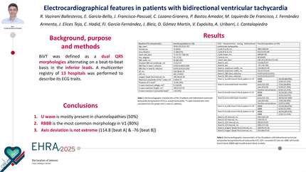 Electrocardiographical features in patients with bidirectional ventricular tachycardia