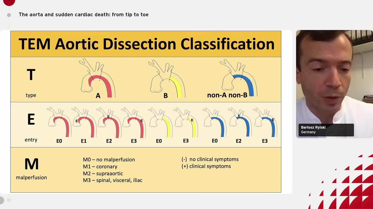 'Watchful waiting' or 'waiting for disaster': treatment dilemmas in acute aortic dissection.