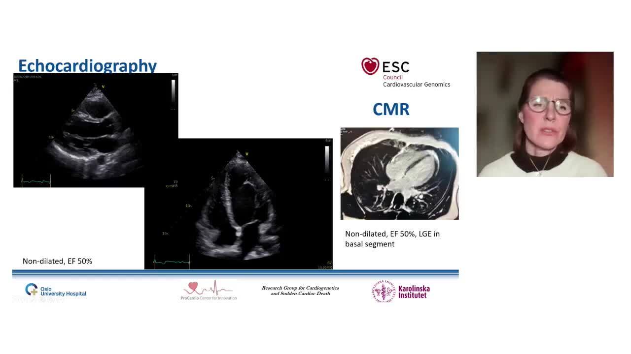 Preimplantation genetic diagnosis and pregnancy in inherited cardiovascular disease