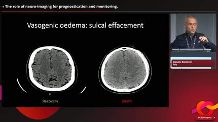 State of the art: imaging during and after cardiac arrest